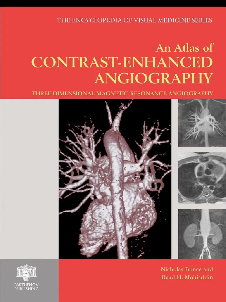 Atlas of Contrast Enhanced Angiography Aorta