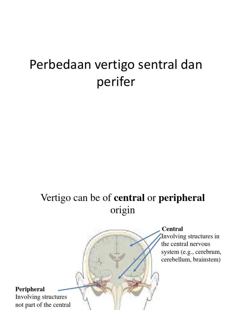 Perbedaan Vertigo Sentral Dan Perifer PDF Vertigo Medical Specialties