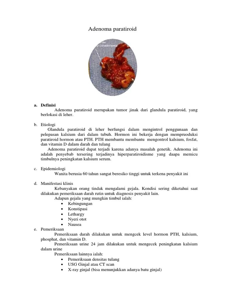 Adenoma Paratiroid