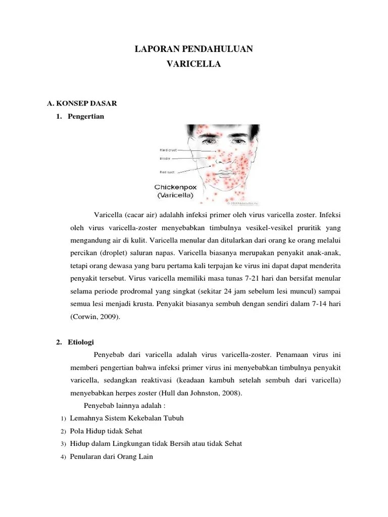 Cacar Air Leaflet PKM BARENG | PDF