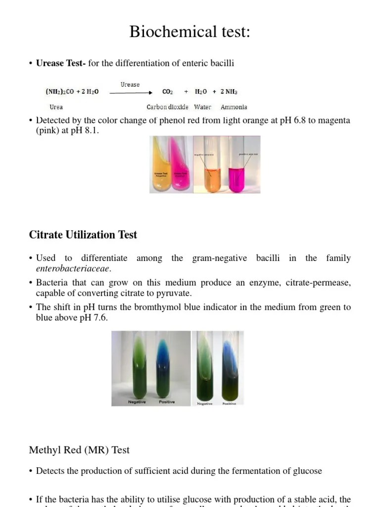 Biochemical test • Urease Testfor the differentiation of enteric