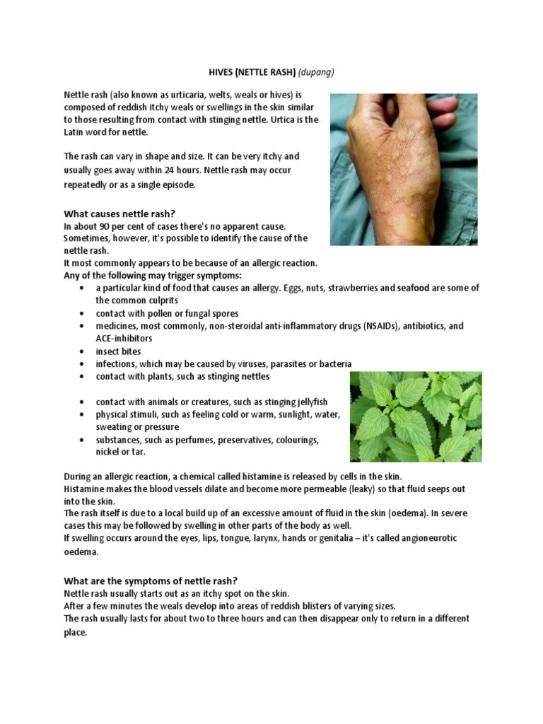 What Causes Nettle Rash? PDF Allergy Immunology