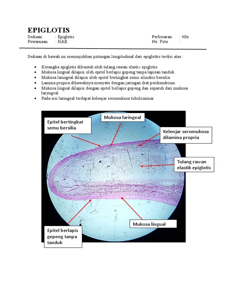 Histologi Epiglotis | PDF