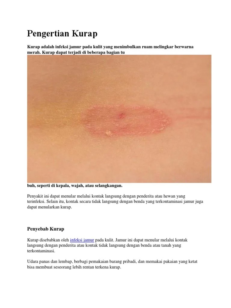 Pengertian Kurap | PDF