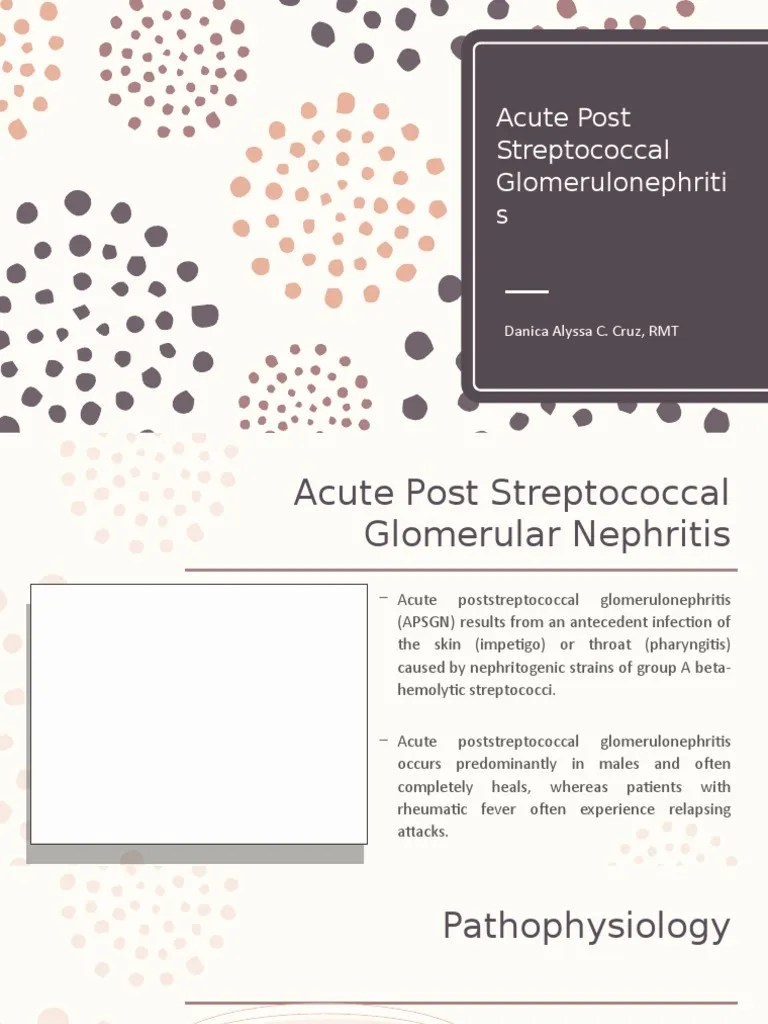 Acute Post Streptococcal Glomerulonephritis PDF Medical Specialties