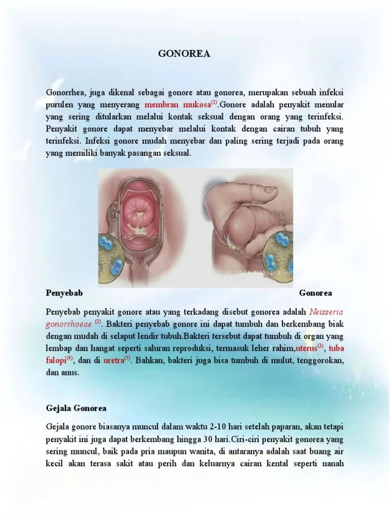 Ian Artikel GONOREA | PDF