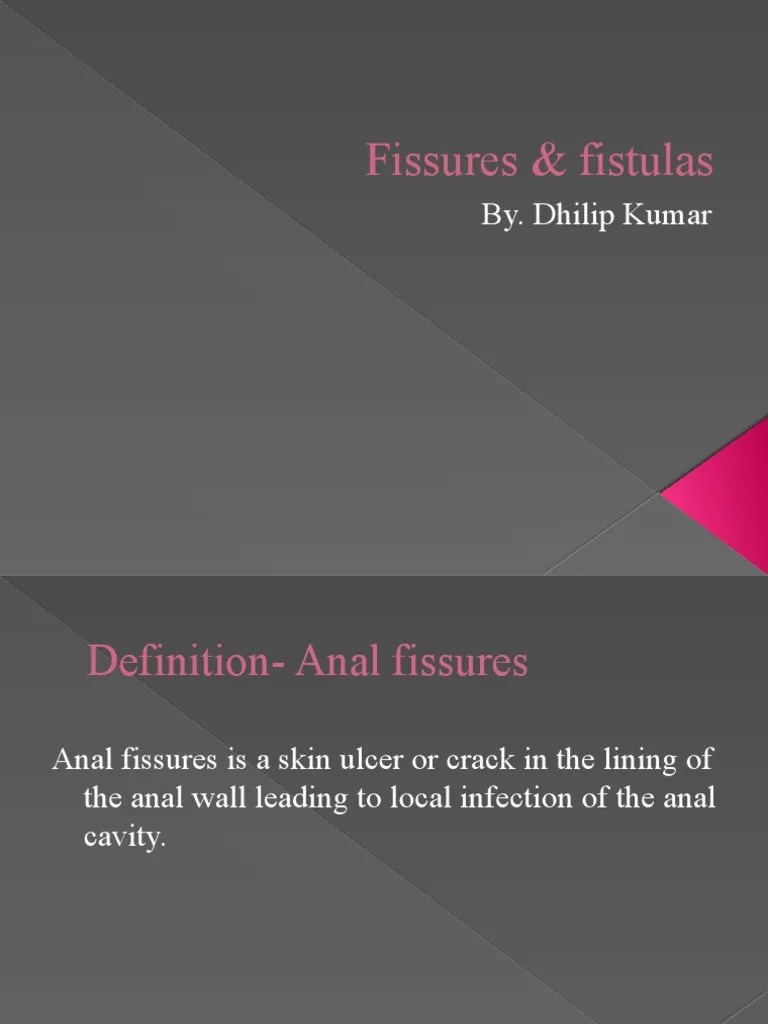 Fissures & Fistulas PDF Constipation Rectum