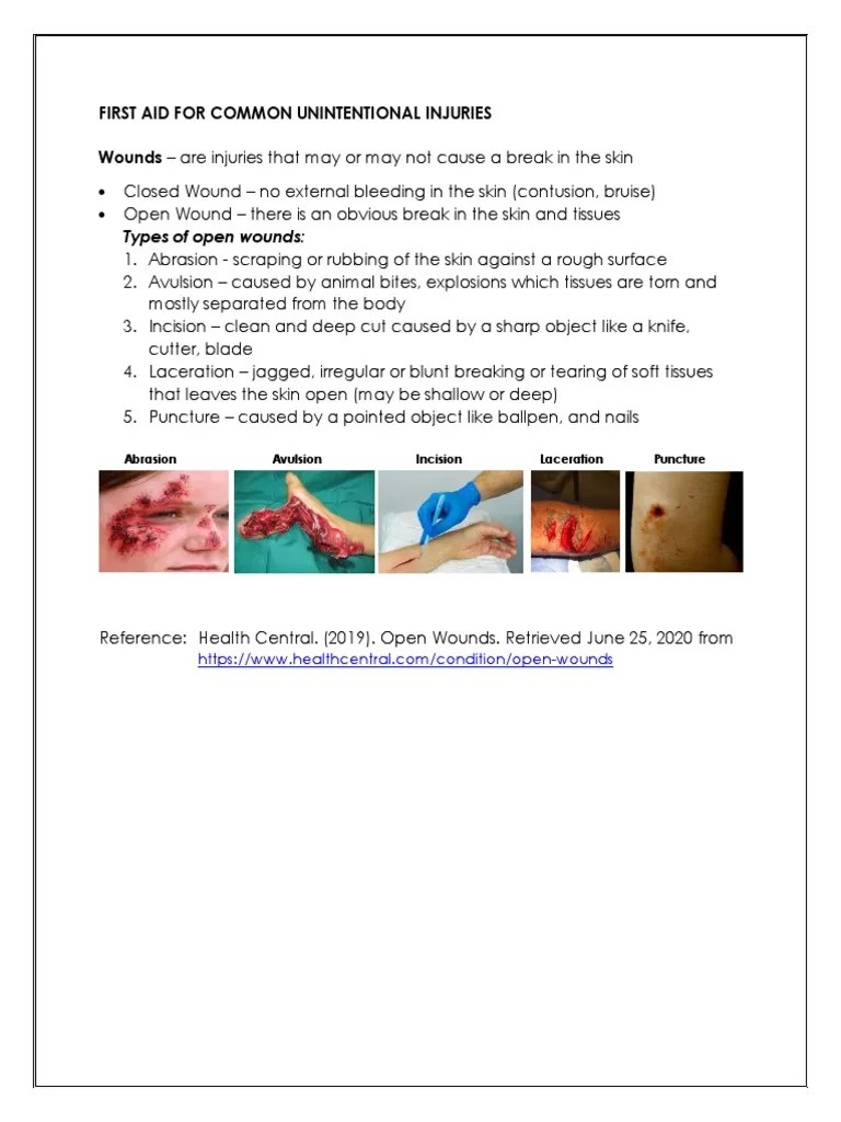 HLTH9 3Q First Aid For Common Unintentional Injuries PDF Wound