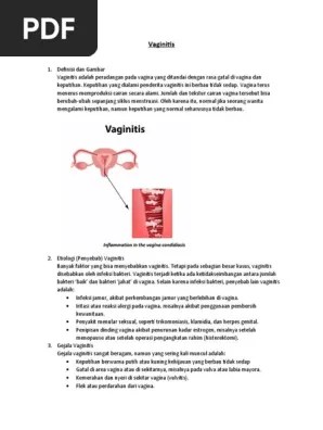 Vaginitis | PDF