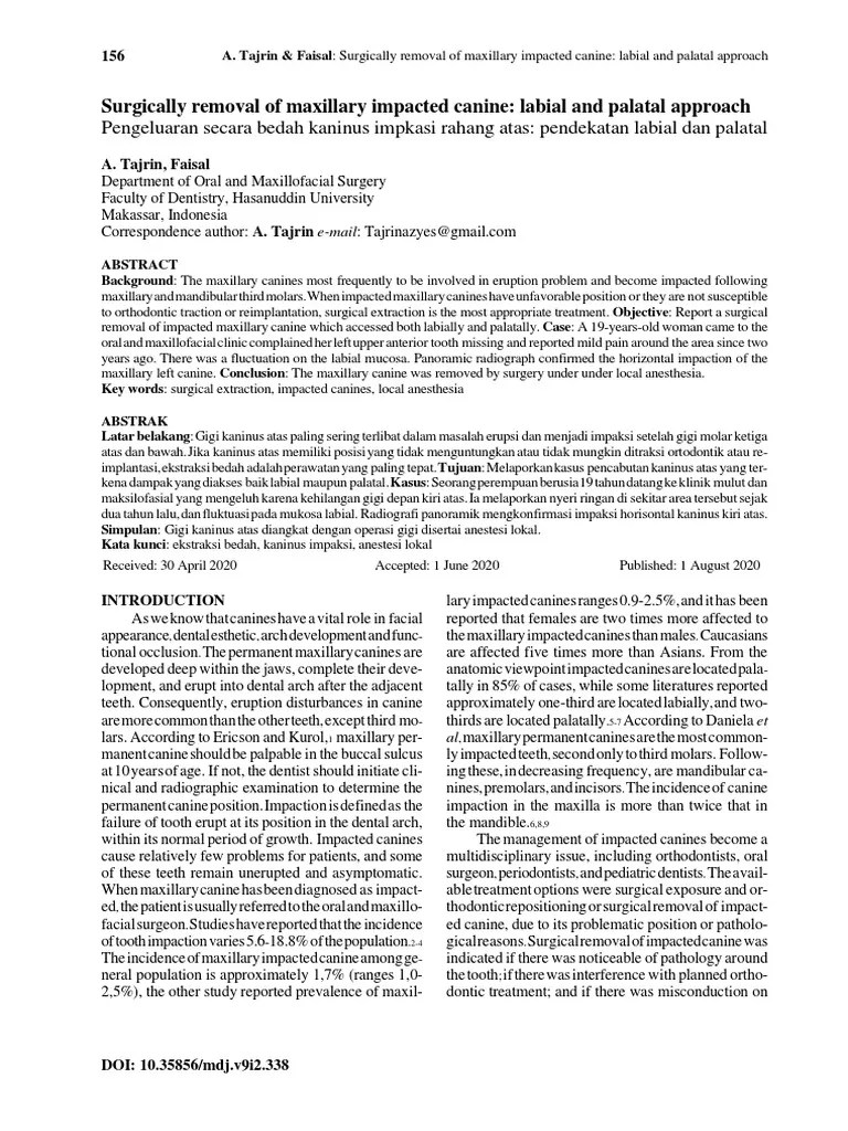 5 Sri Maya Koas 15 Surgically Removal of Maxillary Impacted Canine