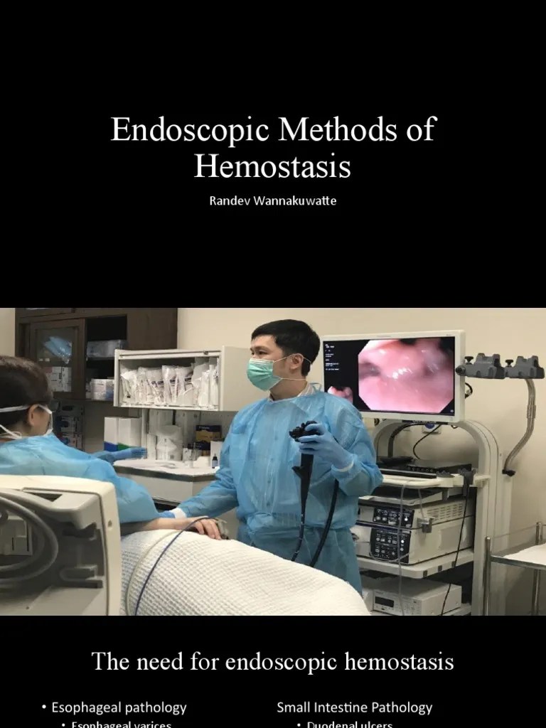 Endoscopic Methods of Hemostasis PDF Hemostasis Coagulation