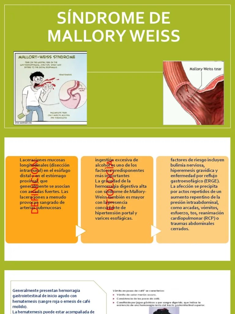 Síndrome de Mallory Weiss PDF Vómitos Medicina CLINICA