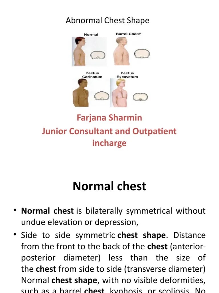 Abnormal Chest Shape Farjana Sharmin Junior Consultant and Outpatient