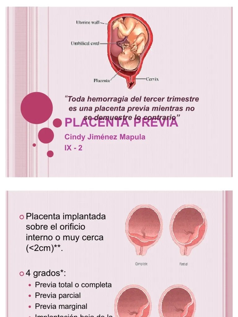 3 Placenta Previa