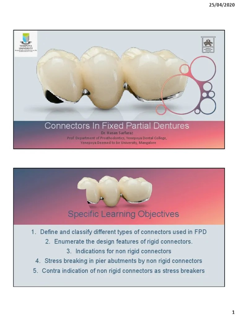 Connectors in Fixed Partial Dentures Design Considerations, Types