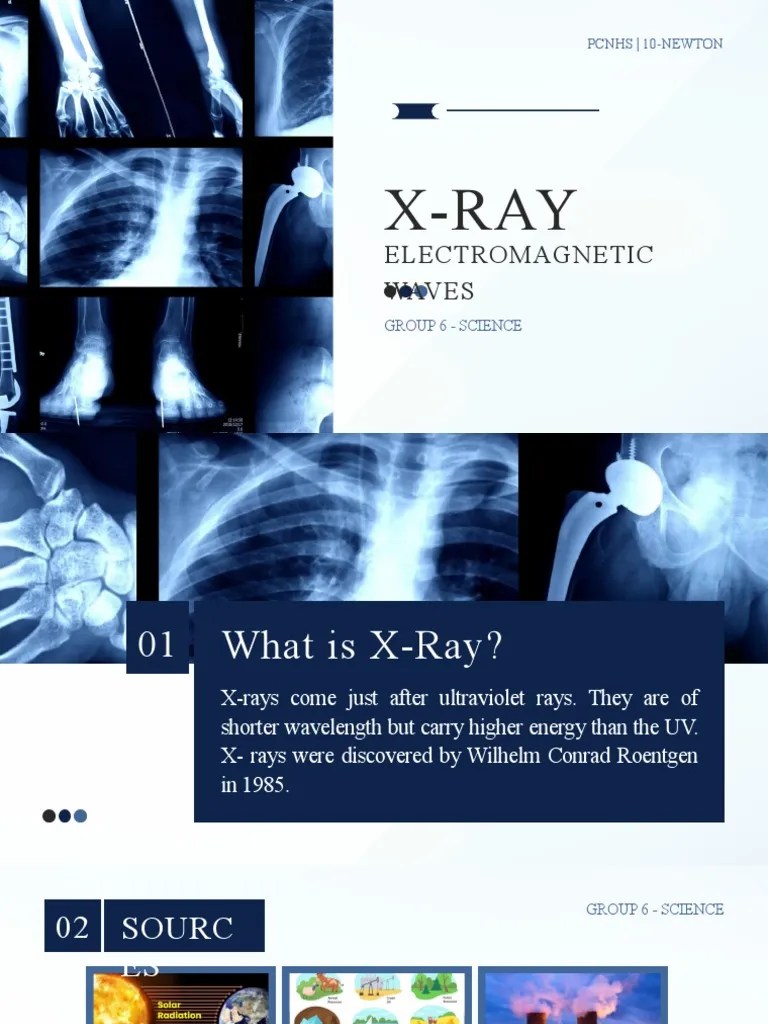 X Ray PDF