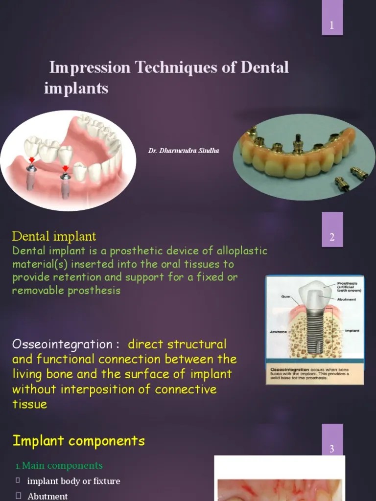 Dental Implant Impression Techniques PDF Dental Implant Computer Aided Design