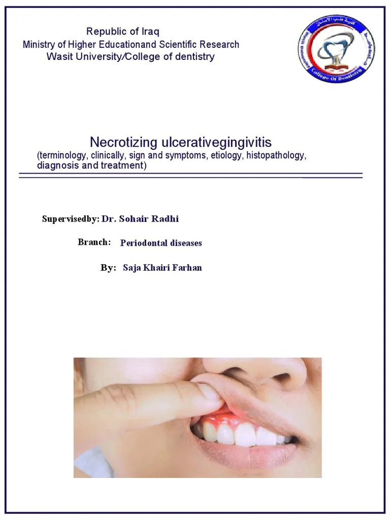 Diagnosing and Treating Necrotizing Ulcerative Gingivitis A Case