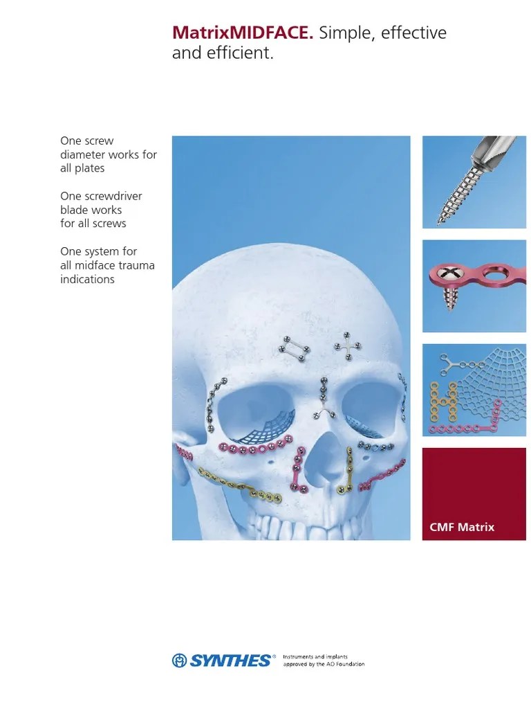 Matrix Midface PDF Drill Screw