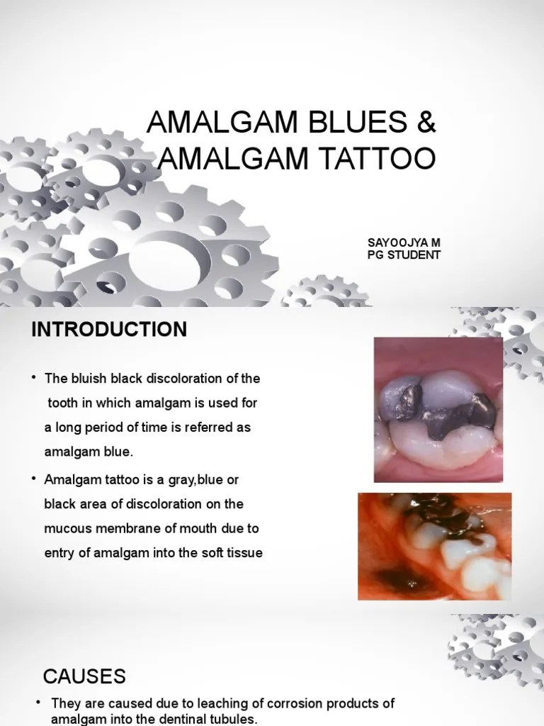 Amalgam Blues PDF