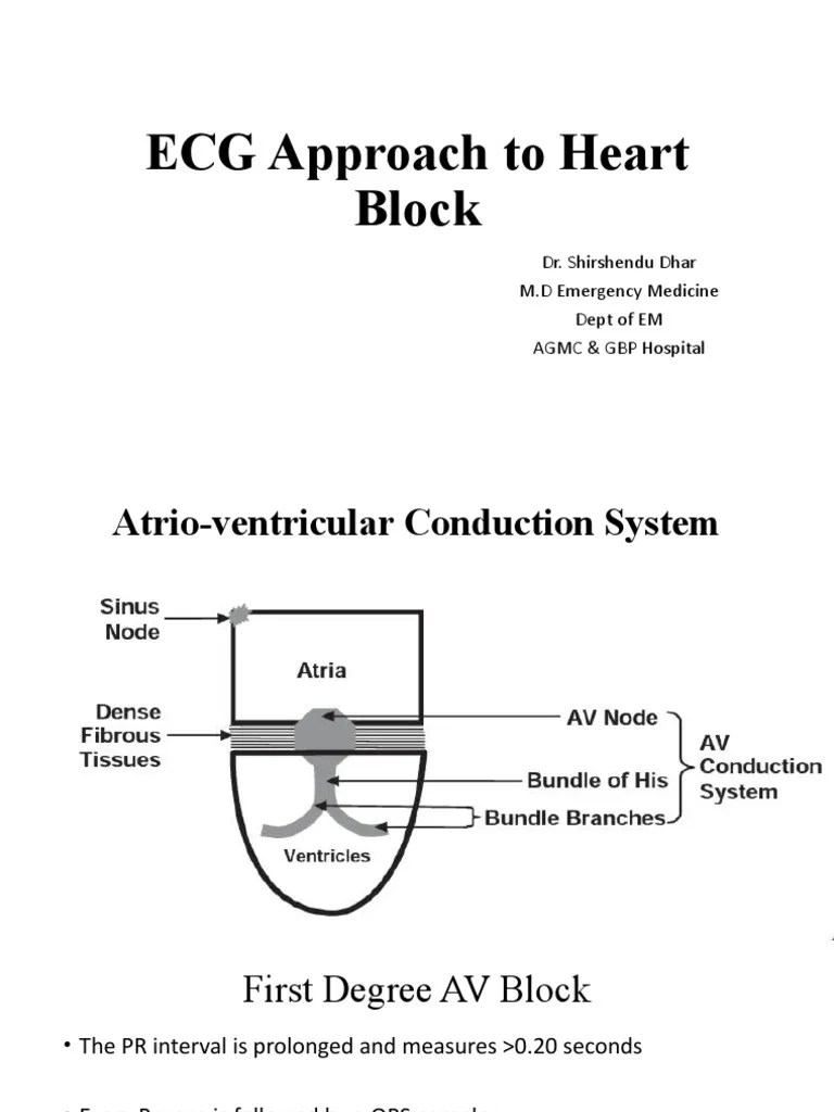 Heart Block PDF Cardiovascular Diseases Cardiac Arrhythmia