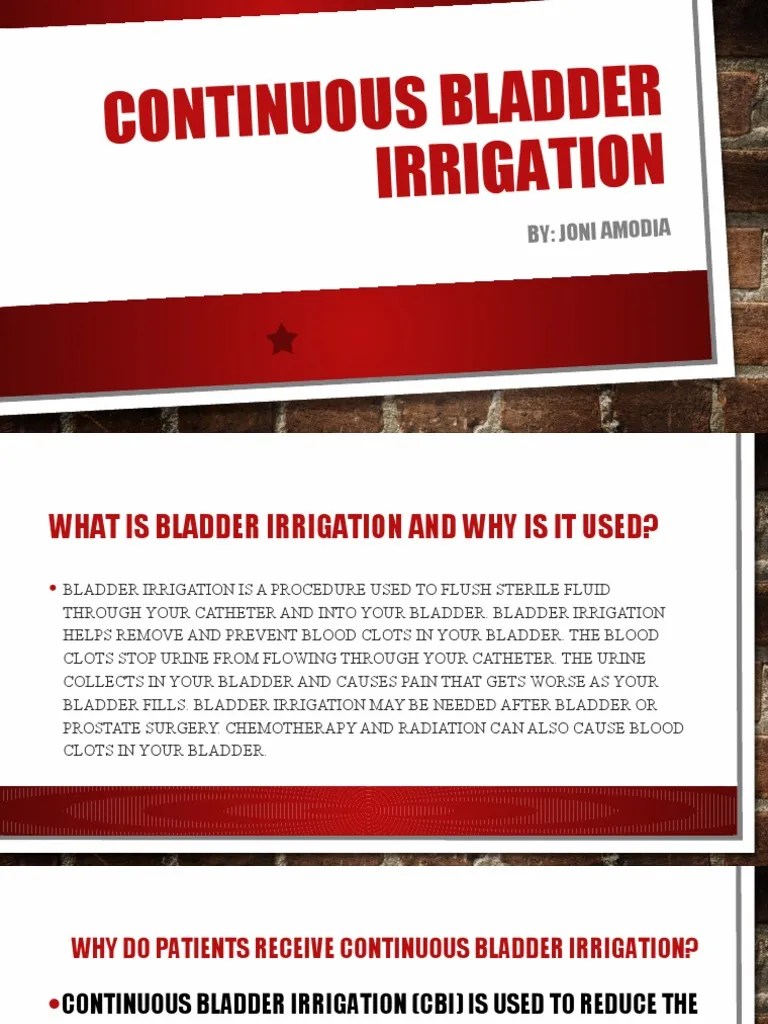 Continuous Bladder Irrigation PDF Urinary Bladder Diseases And