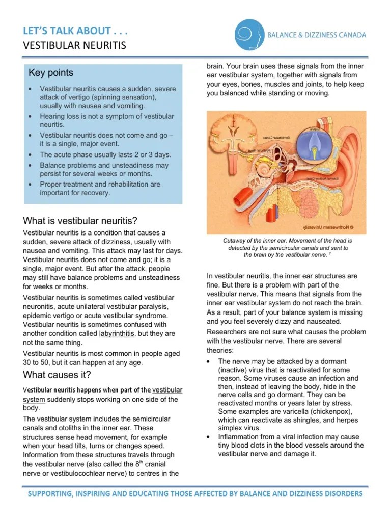 Vestibular Neuritis Handout PDF Vertigo Vestibular System