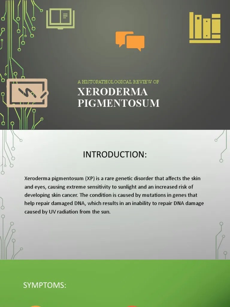 Xeroderma Pigmentosum PDF Disorder Medical Specialties