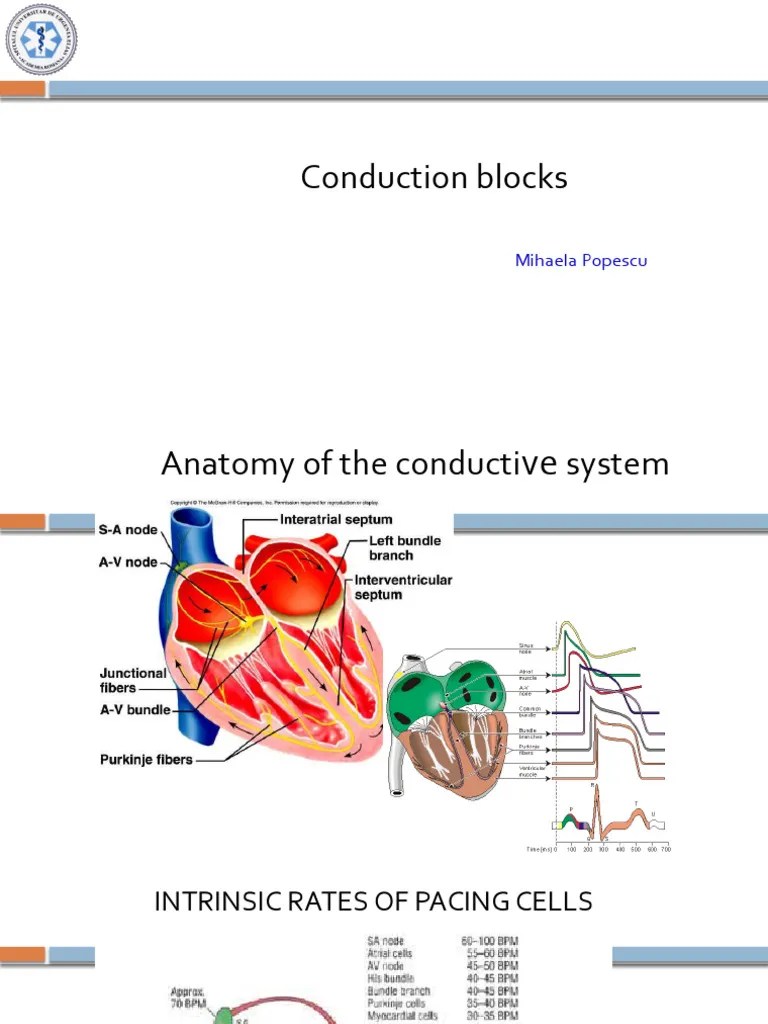 AV Conduction Blocks, BBB PDF Electrocardiography Cardiac