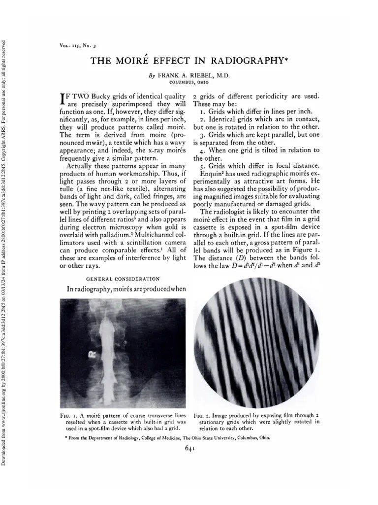 Riebel 2012 The Moiré Effect in Radiography PDF