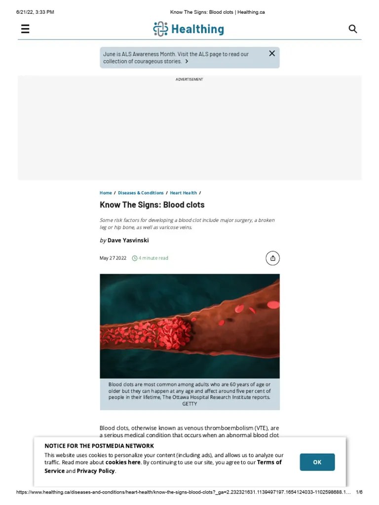 Know The Signs Blood Clots Healthing Ca PDF Thrombosis Vein
