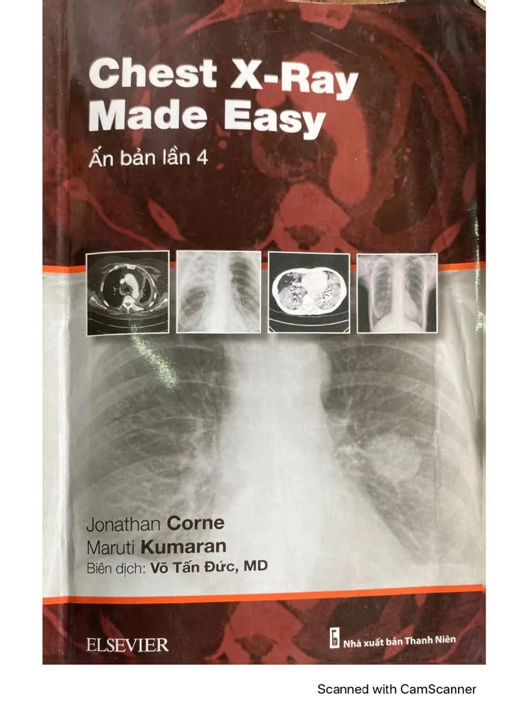 Chest Xray Made Easy PDF