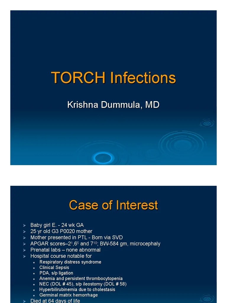 TORCH Infections Congenital Disorder Medical Specialties
