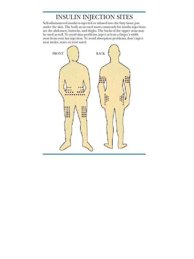 Insulin Injection Sites and Types of Insulins A Guide to Proper