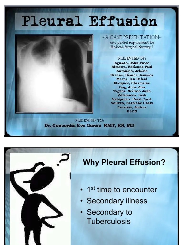 Pleural Effusion Ppt Lung Medicine