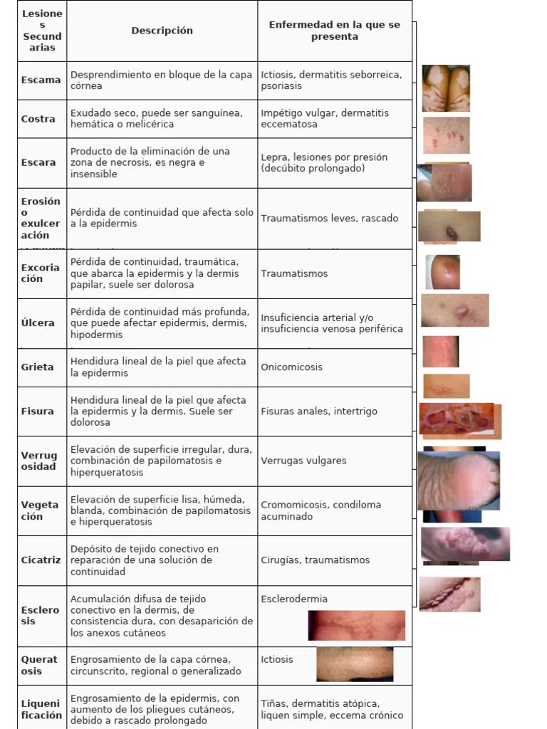 Tipos de lesiones cutáneas y sus causas PDF Piel Epidermis