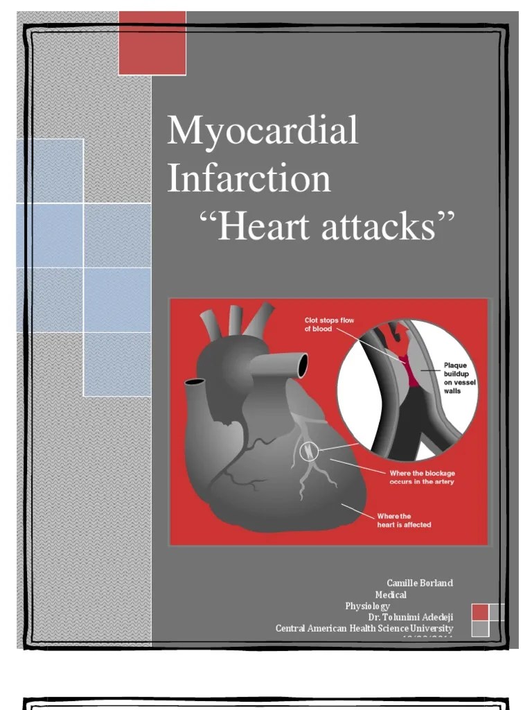 Myocardial Infarction Percutaneous Coronary Intervention Myocardial
