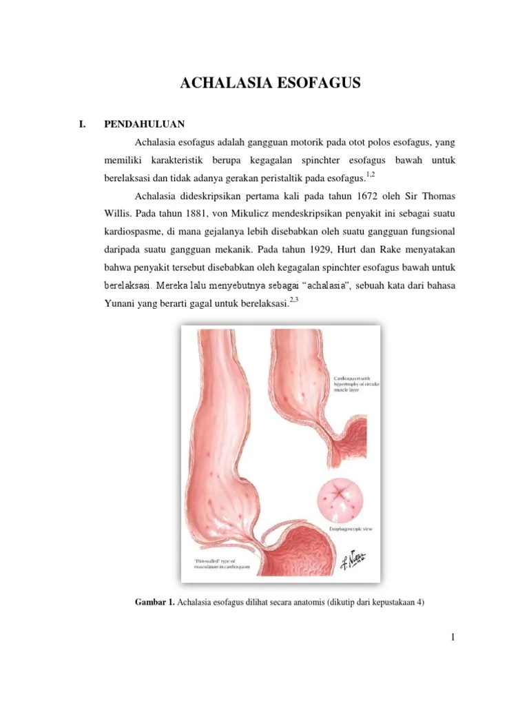 ACHALASIA ADALAH PDF