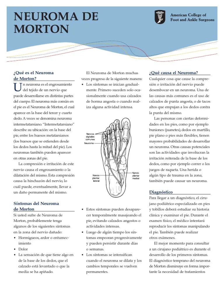 Morton_s_Neuroma_S Pie Cirugía