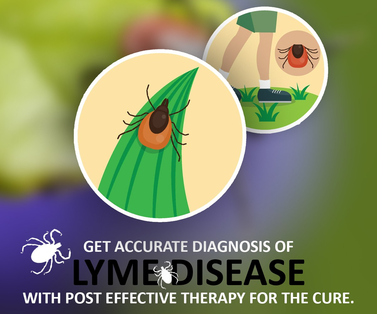 The Easiest Way to Cure Lyme Disease Treatment IMNVA Lyme Disease