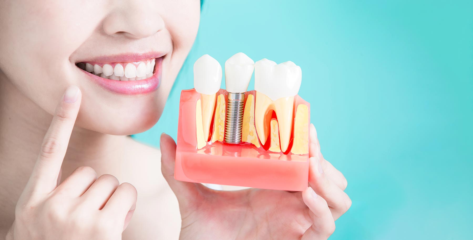 Dentist in Anaheim, CA Local Dentist Impladent Implant & Cosmetic
