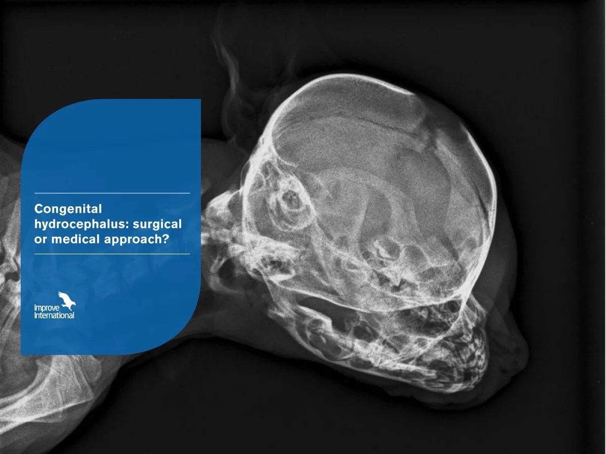Congenital hydrocephalus surgical or medical approach? Improve