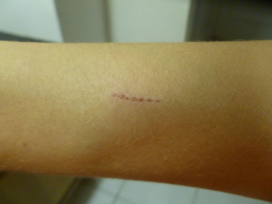 Anomalous Markings includes photos Updated 4/6/20 In 2 Worlds