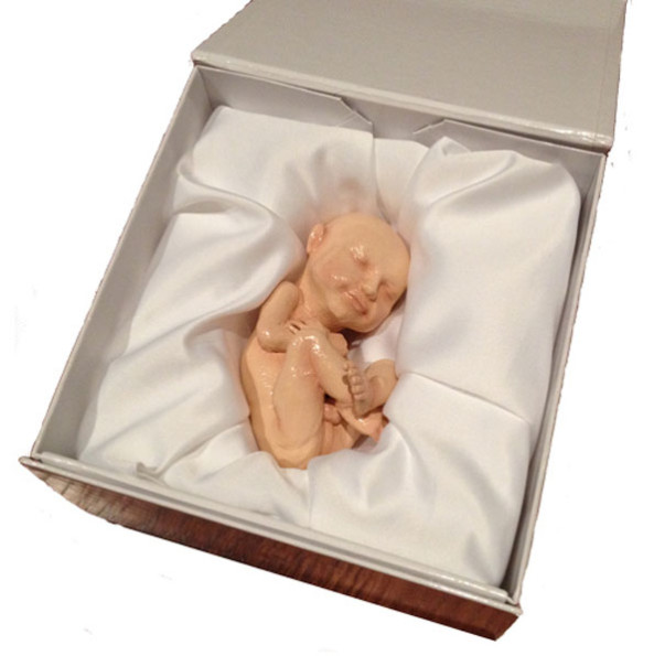 3D Printed Model Of Your Fetus Incredible Things