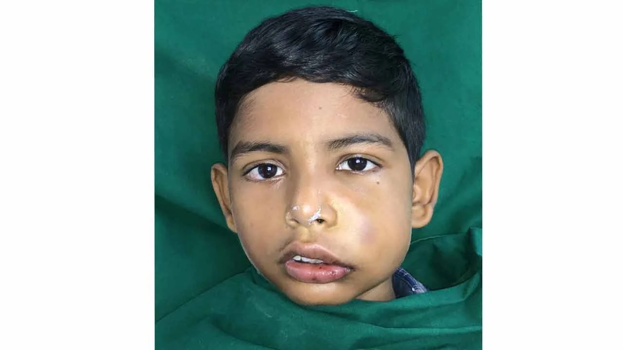 Turned away by hospitals, this 11yearold saved his eyes with the