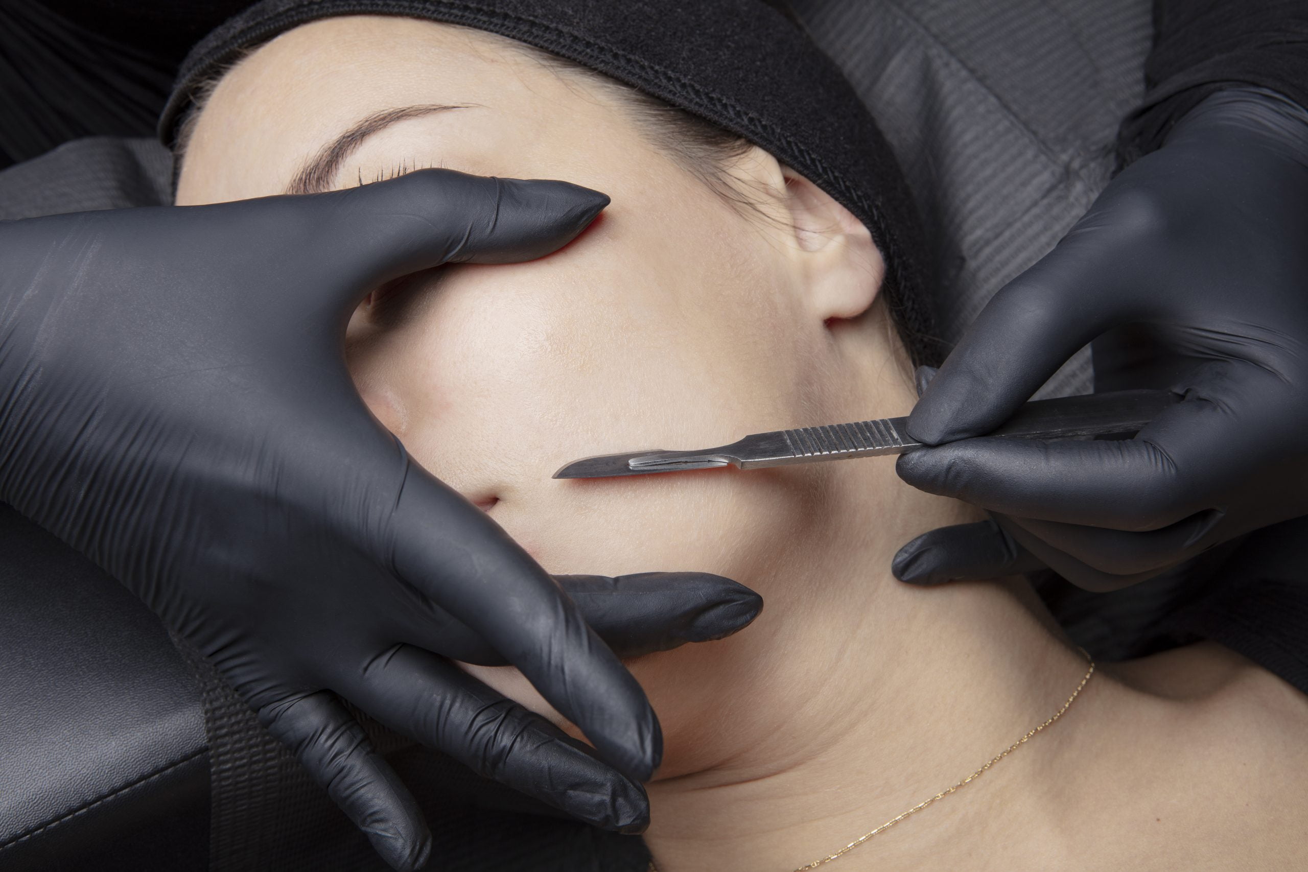 Dermaplaning Facial Hair Removal in Las Vegas, NV