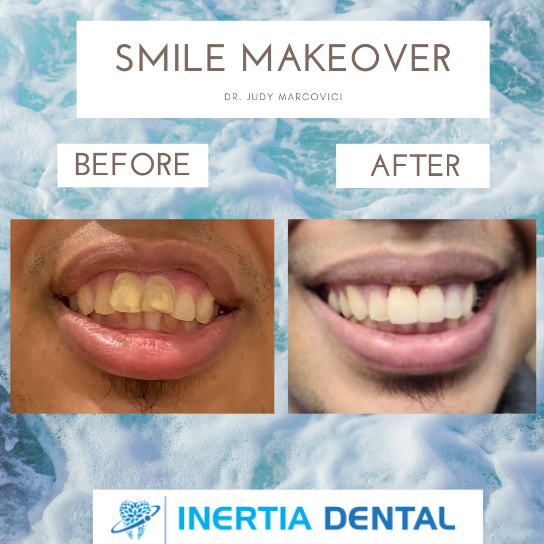 Repairing Smiles in North Reading, MA Inertia Dental