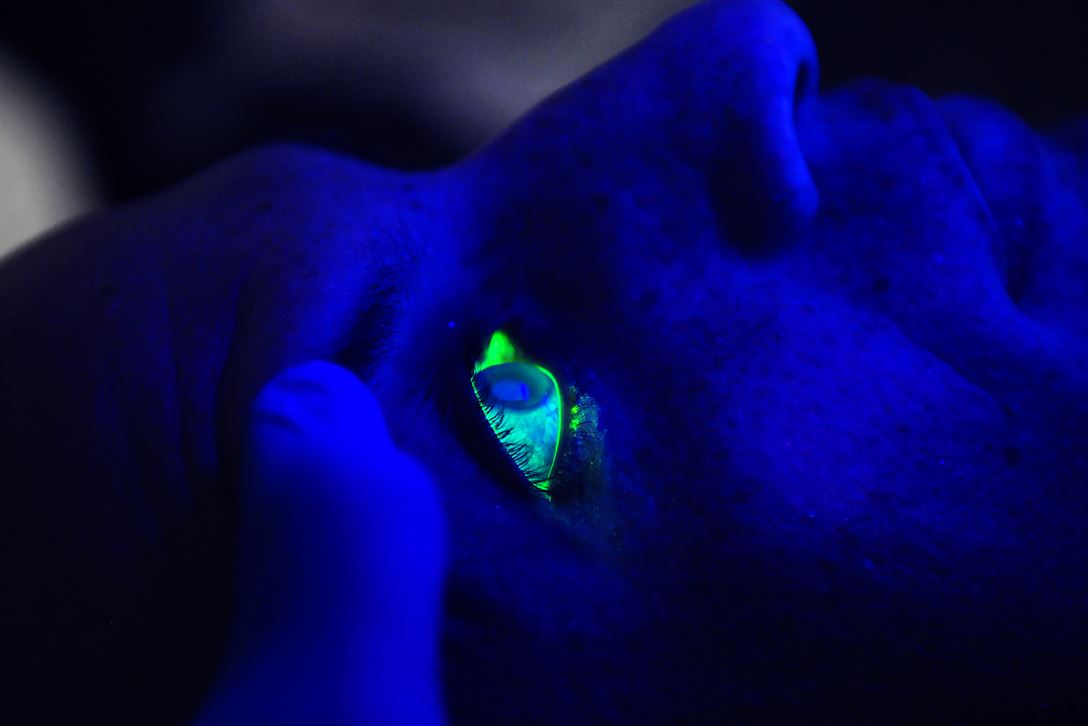 A black light illuminates a man’s eye after he received fluorescein drops during an exam. (U.S. Department of Defense)