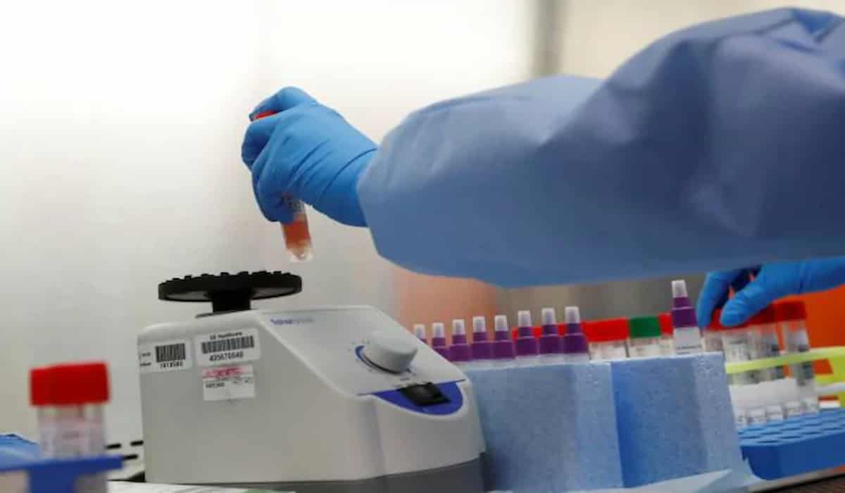 States Not Conducting Enough RTPCR Tests InFeed Facts That Impact