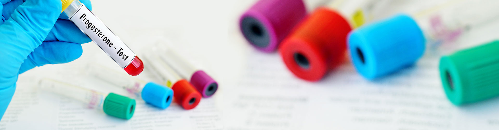 Male and Female Fertility Testing in New Jersey Fertility Docs